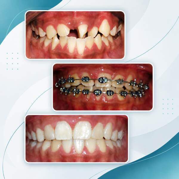 Orthodontics
