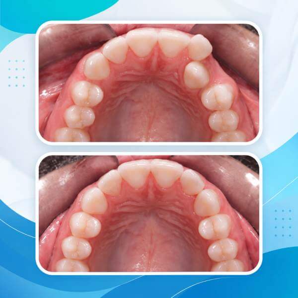 Orthodontics