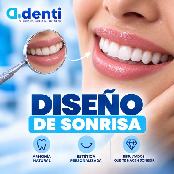 Diseño de sonrisa 