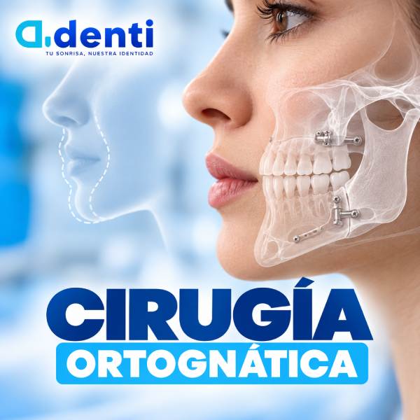 Cirugía ortognática