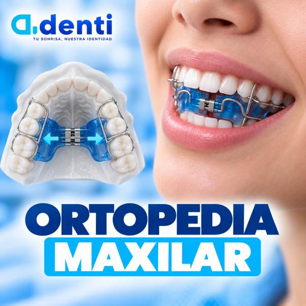 Ortopedia maxilar