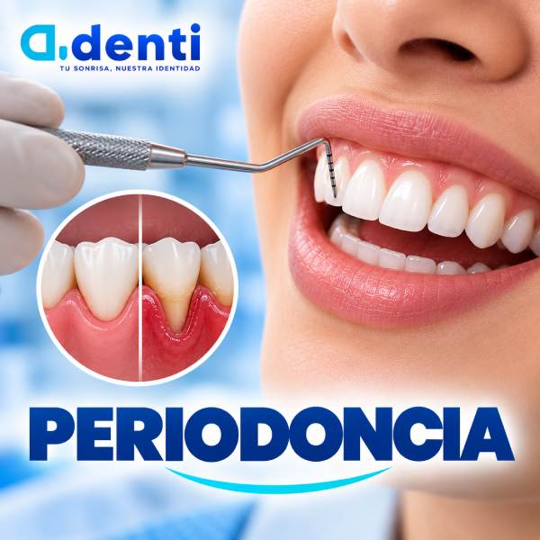 Periodoncia