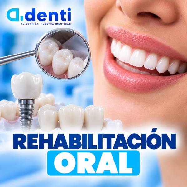Rehabilitación oral