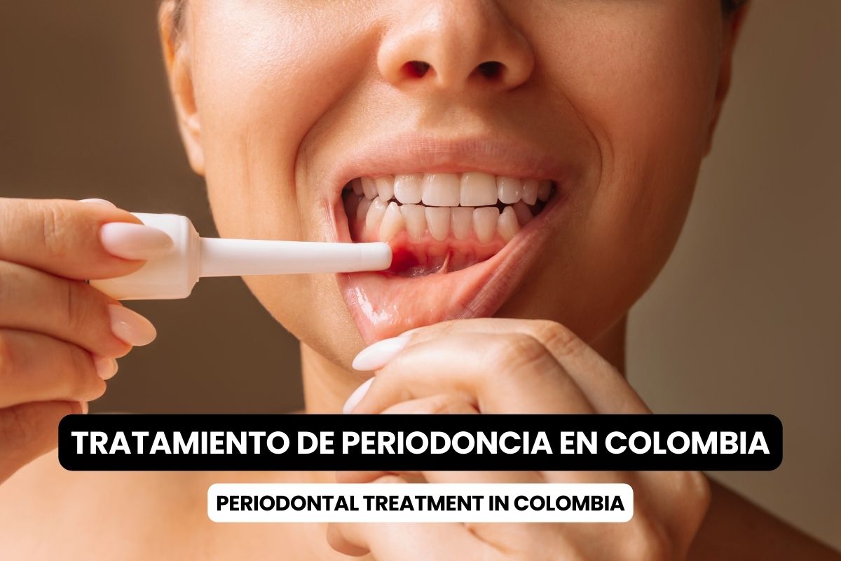 Periodontal Treatment in Colombia