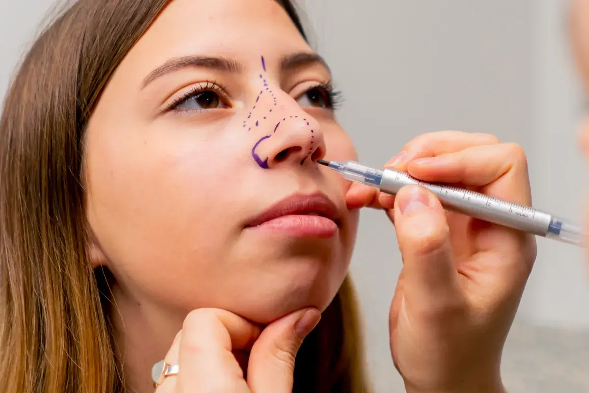 Rhinoplasty in Colombia - Nose Job Prices in Colombia