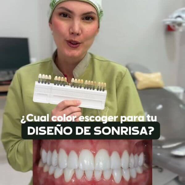 Smile design