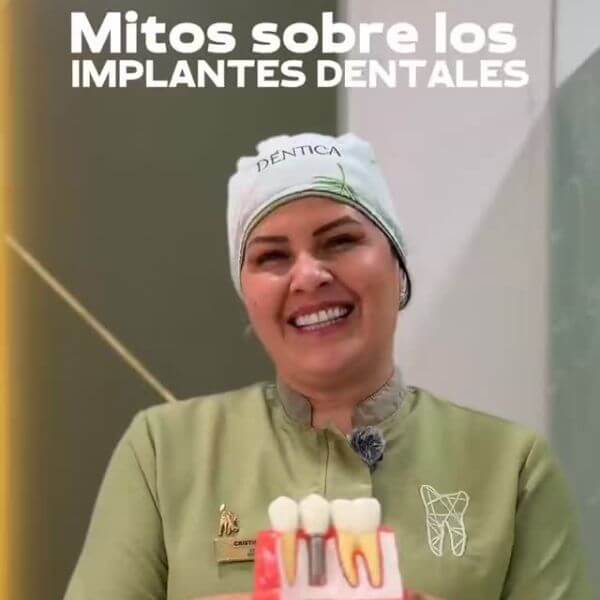 Dental implants