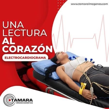 Electrocardiograma