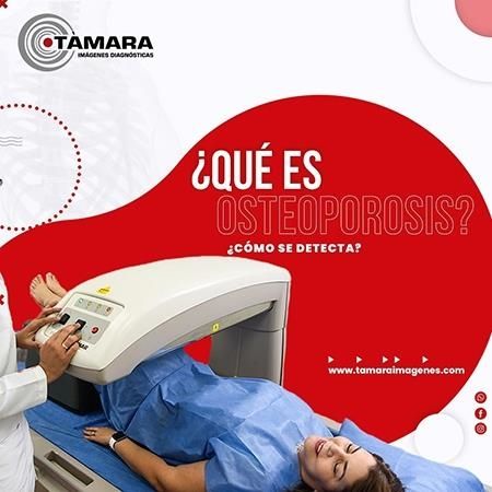 Exámen para detectar la osteoporosis