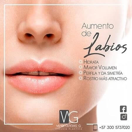 Aumento de labios