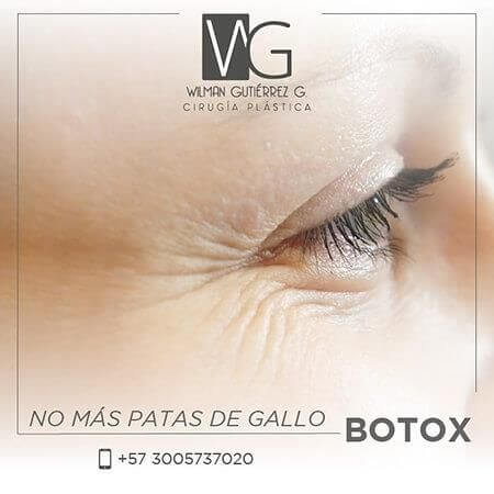 Botulinum toxin (Botox)