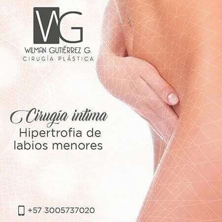 Cirugía íntima