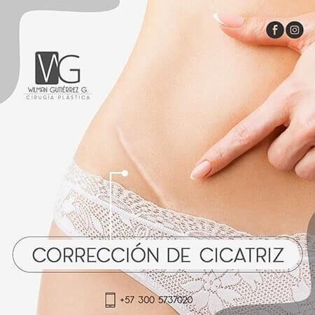Scar correction