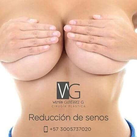 Breast reduction surgery