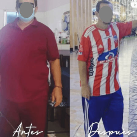 Cirugía bariátrica