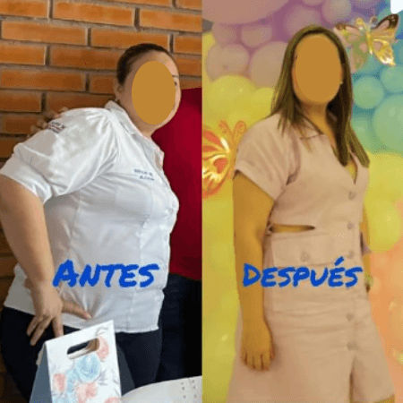Cirugía bariátrica