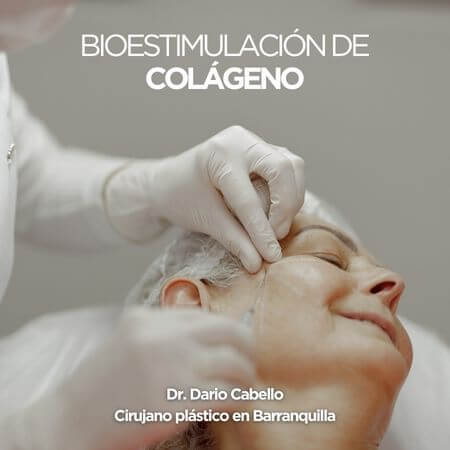 Bioestimulador de colágeno