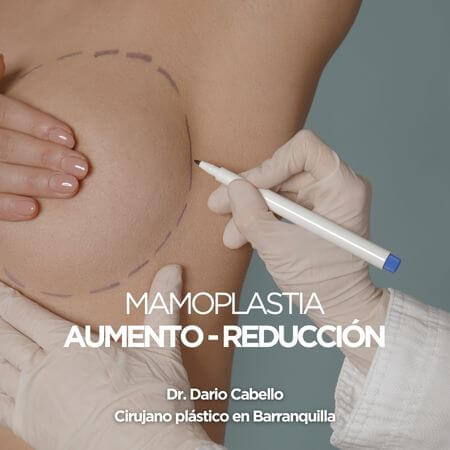 Mamoplastia de aumento o reducción