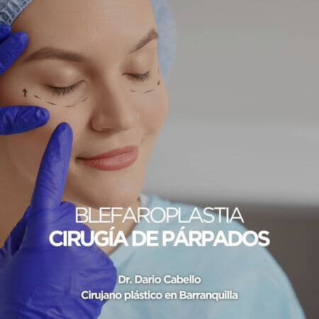 Blefaroplastia o cirugía de párpados