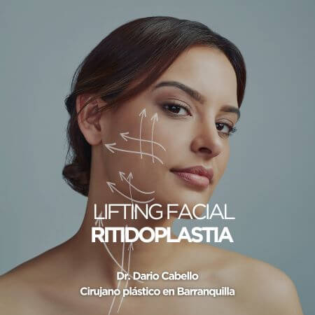 Lifting facial