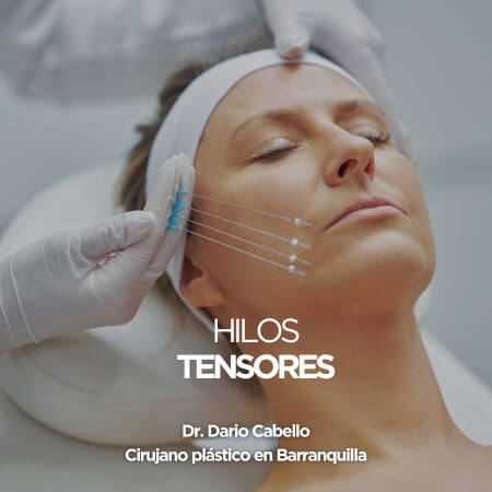 Hilos tensores