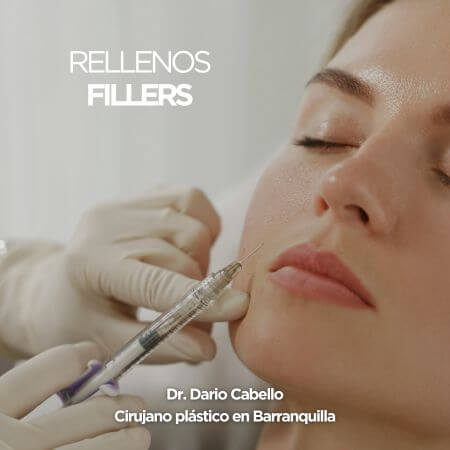Rellenos faciales o fillers