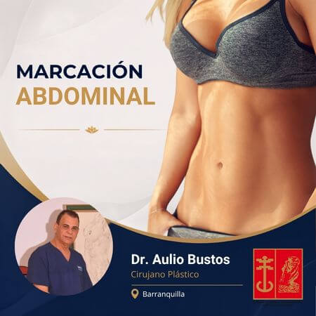 Marcación abdominal
