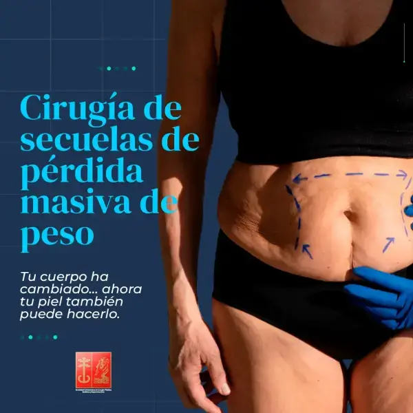 Post-bariatric surgery