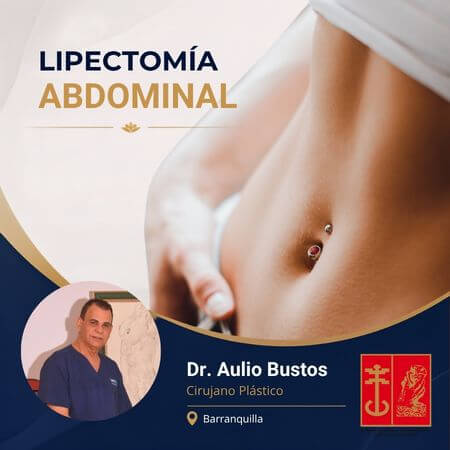 Abdominoplastia