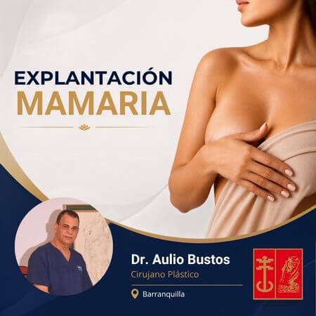 Explantación mamaria