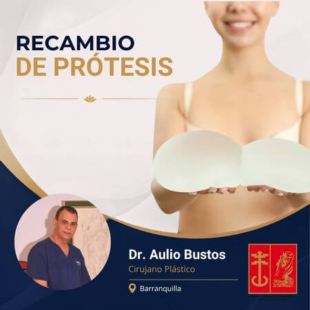 Recambio de prótesis mamarias