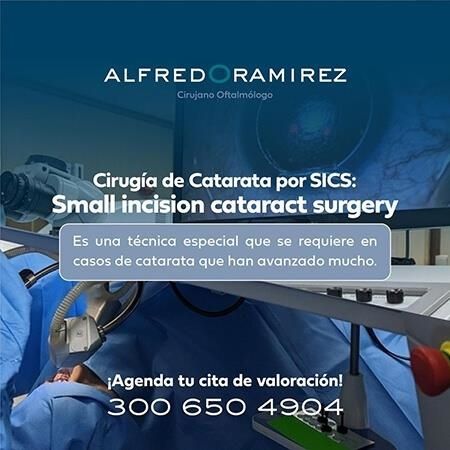 Cataract surgery
