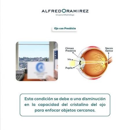 Presbicia