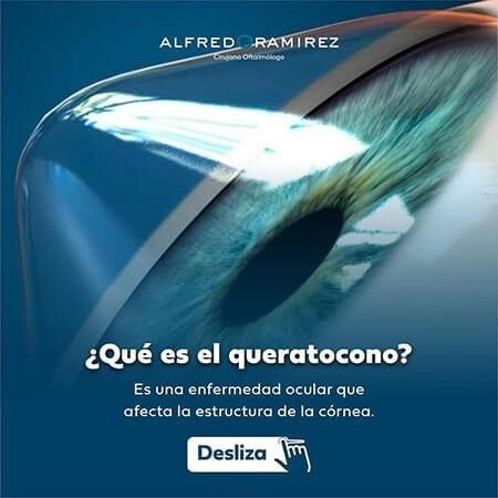 Queratocono