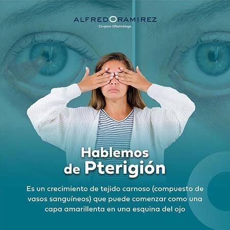 Pterigión