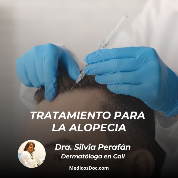 Tratamiento para la alopecia 