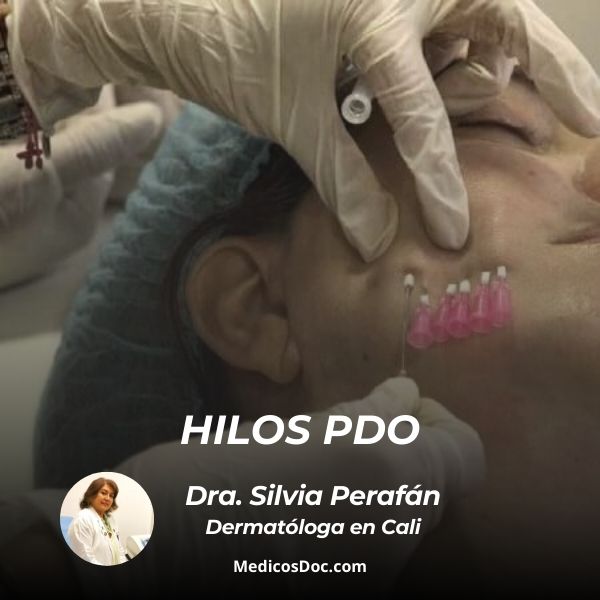 Hilos PDO