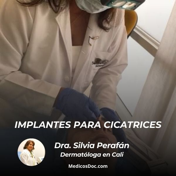 Implantes para cicatrices