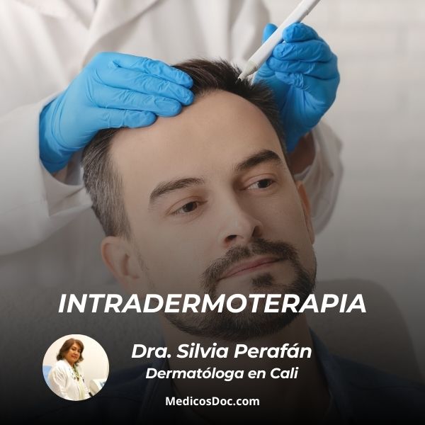 Intradermoterapia - Tratamiento para alopecia