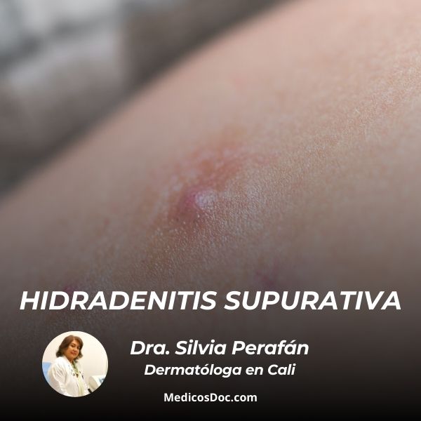 Hidradenitis supurativa