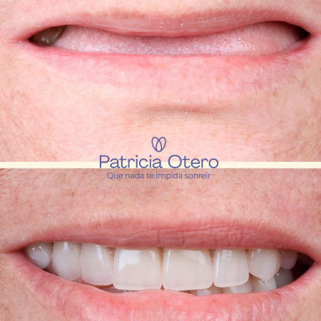 Rehabilitación oral