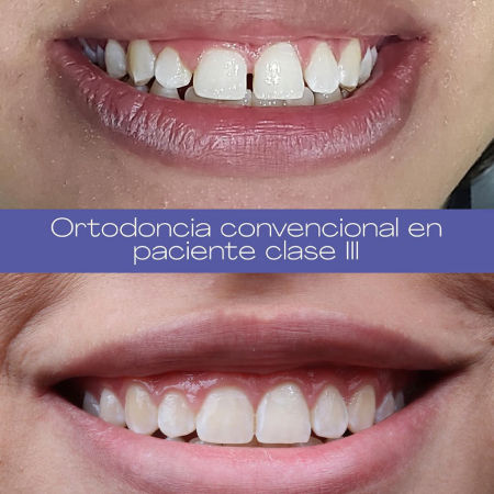 Ortodoncia