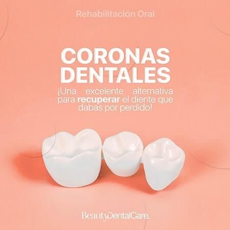 Corona dental