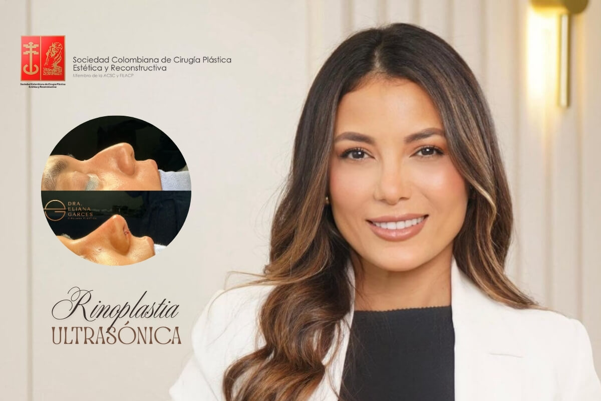 Nose job in Barranquilla with Dr. Eliana Garcés – Natural, Safe, and Personalized Results