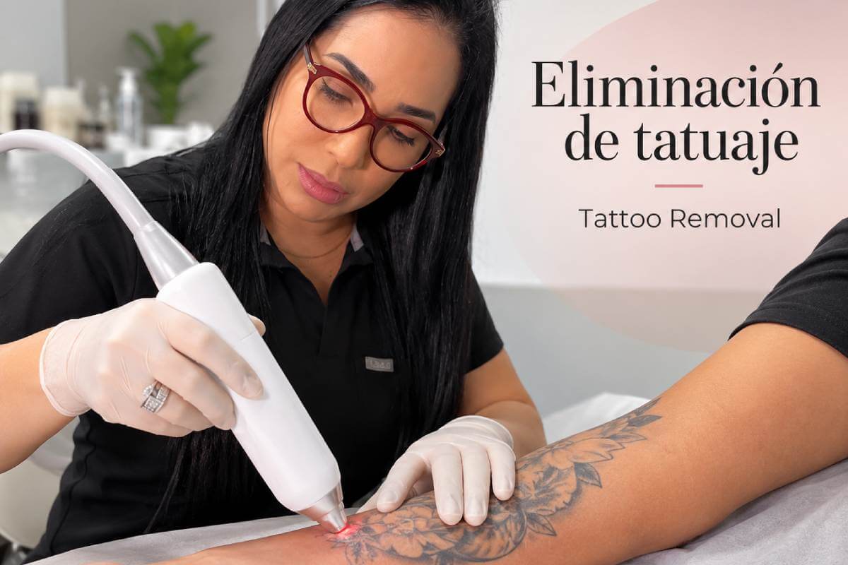 Laser Tattoo Removal in Barranquilla: Technology and Specialized Care