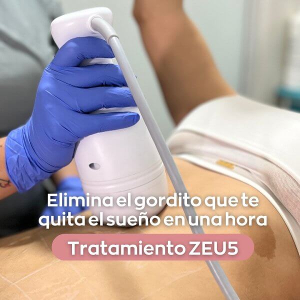 Elimina gorditos con la tecnología Zeus