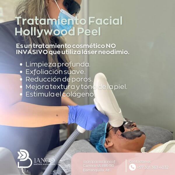 Hollywood Peel