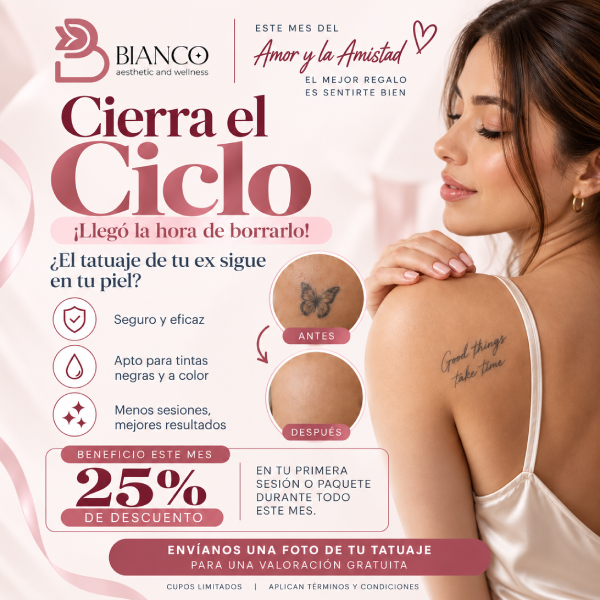 Eliminación de tatuajes