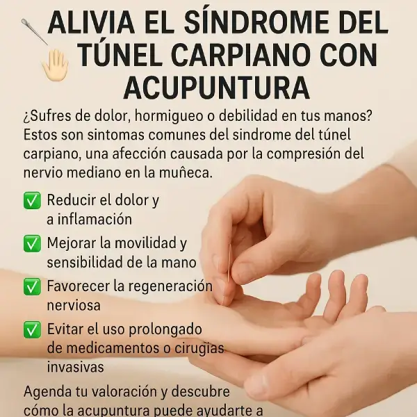 Alivia el síndrome del túnel carpiano