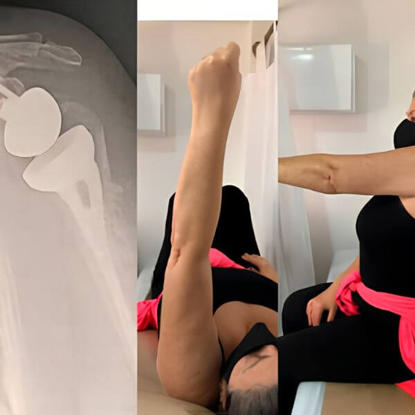 Shoulder physical therapy